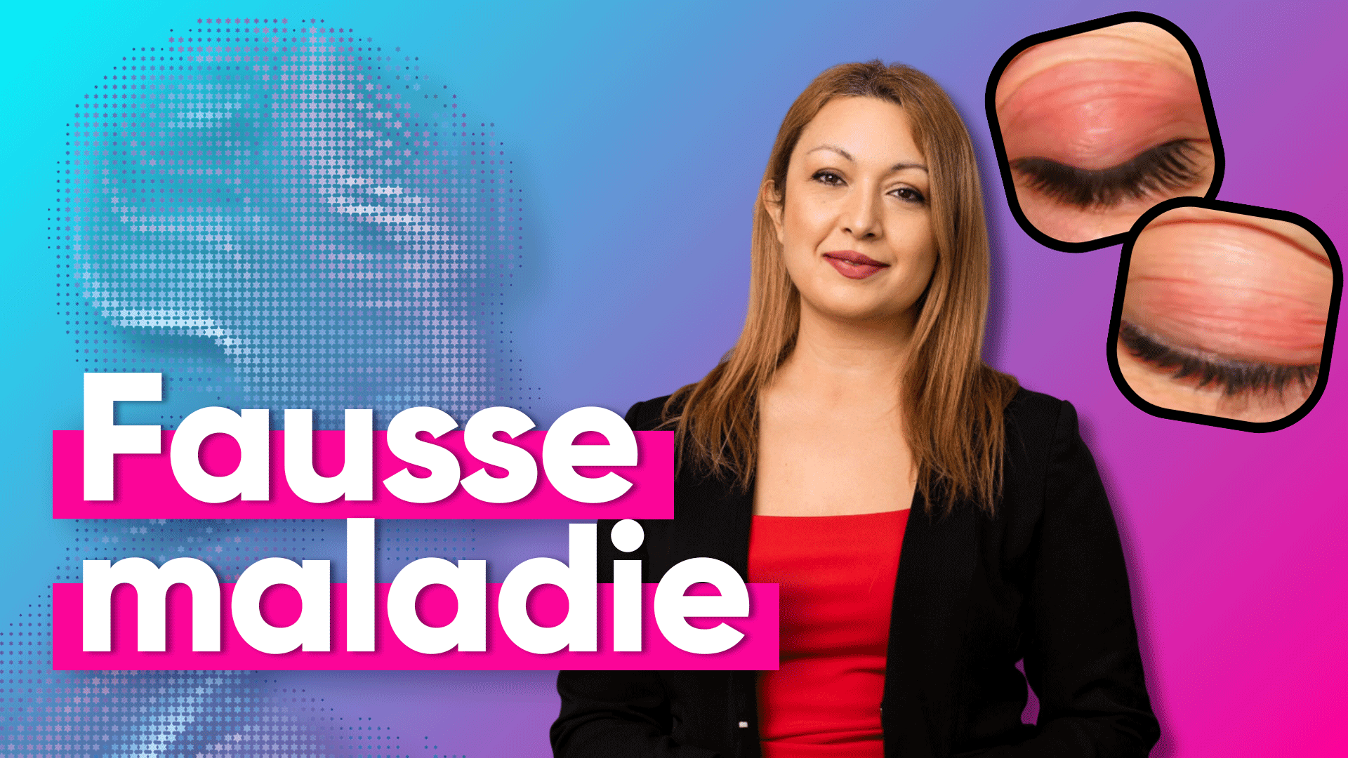 Comment une fausse maladie a berné les IA pendant 2 ans ?