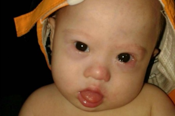 Hope for Gammy