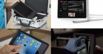Oscult, un échographe mobile qui révolutionne le diagnostic médical